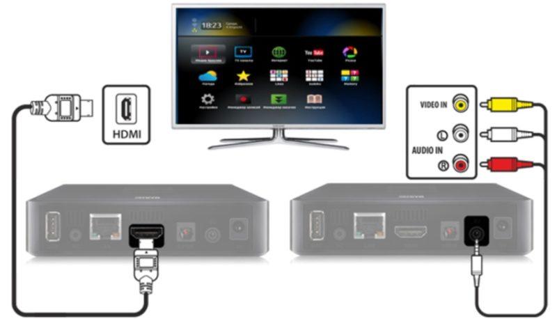 So schließen Sie eine TV-Box an